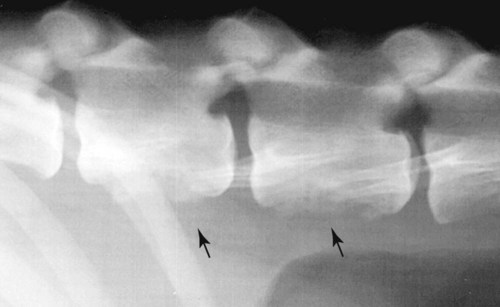 Pertumbuhan tulang baru periosteal (panah) terdapat pada aspek ventral corpus vertebral L-2 dan L-3. (Courtesy David F. Edwards, Universitas Tennessee, Knoxville, TN.)